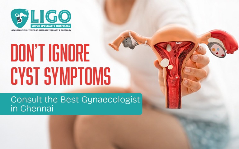 Ovarian cyst treatment in Chennai when does surgery become necessary
